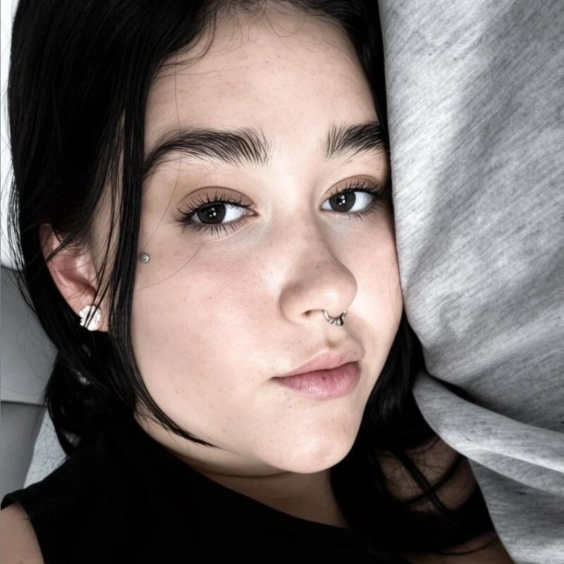 frecklesz